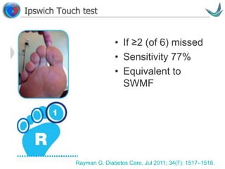 Vascular surgery @ Tallaght
Ipswich Touch test
• If ≥2 (of 6) missed
• Sensitivity 77%
• Equivalent to
SWMF
Rayman G. Diabetes Care. Jul 2011; 34(7): 1517–1518.
 