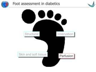 Vascular surgery @ Tallaght
Foot assessment in diabetics
Structural
Skin and soft tissue
Innervation
Perfusion
 