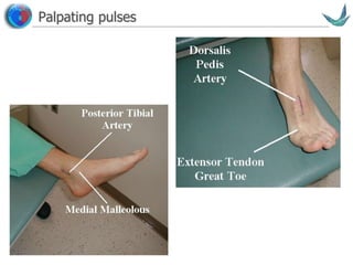 Vascular surgery @ Tallaght
Palpating pulses
 