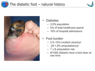Vascular surgery @ Tallaght
The diabetic foot – natural history
• Diabetes
– 3.5% population
– 5% of total healthcare spend
– 10% of hospital admissions
• Foot burden
– 2.5–10% incident ulcers/yr
– .25-1.8% amputations/yr
–  x 8 amputation risk
– 9/1000 diabetic have a foot ulcer at
one time
 