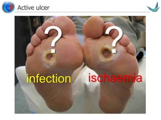 Vascular surgery @ Tallaght
Active ulcer
?
infection
?
ischaemia
 