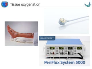 Vascular surgery @ Tallaght
Tissue oxygenation
 