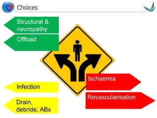 Vascular surgery @ Tallaght
Choices
Structural &
neuropathy
Offload
Ischaemia
Revascularisation
Infection
Drain,
debride, ABx
 