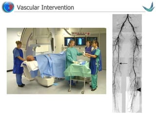 Vascular surgery @ Tallaght
Vascular Intervention
 