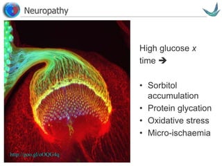 Vascular surgery @ Tallaght
Neuropathy
http://goo.gl/oOQG4q
High glucose x
time 
• Sorbitol
accumulation
• Protein glycation
• Oxidative stress
• Micro-ischaemia
 