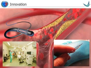 Vascular surgery @ Tallaght
Innovation
 