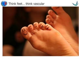 Vascular surgery @ Tallaght
Think feet… think vascular
 