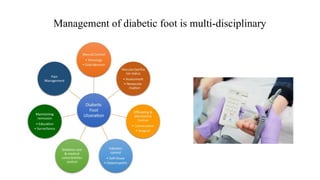 Management of diabetic foot is multi-disciplinary
 