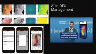 AI in DFU
Management
 