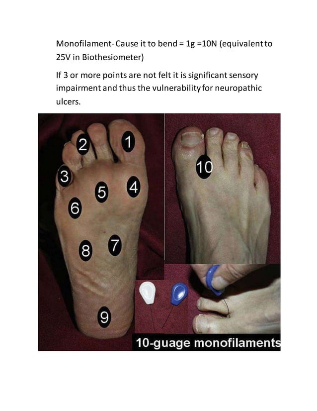 Diabetic foot examination