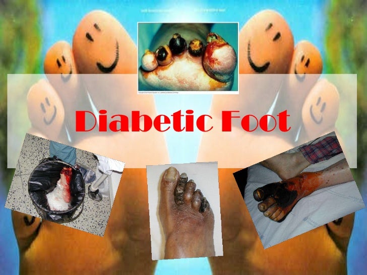 Diabetic foot + gangrene