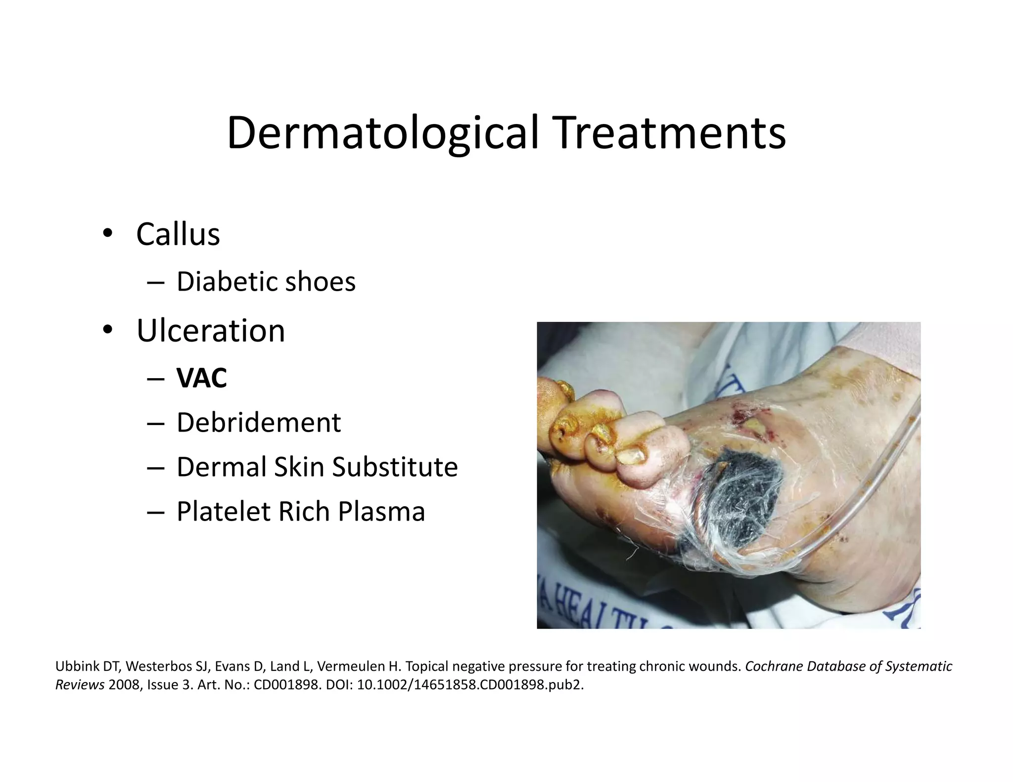 Dermatological Treatments
       • Callus
              – Diabetic shoes
       • Ulceration
              –    VAC
              –    Debridement
              –    Dermal Skin Substitute
              –    Platelet Rich Plasma



Ubbink DT, Westerbos SJ, Evans D, Land L, Vermeulen H. Topical negative pressure for treating chronic wounds. Cochrane Database of Systematic
Reviews 2008, Issue 3. Art. No.: CD001898. DOI: 10.1002/14651858.CD001898.pub2.
 
