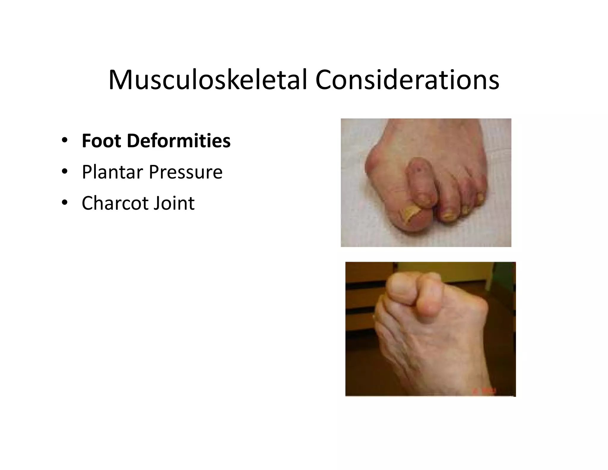Musculoskeletal Considerations
• Foot Deformities
• Plantar Pressure
• Charcot Joint
 