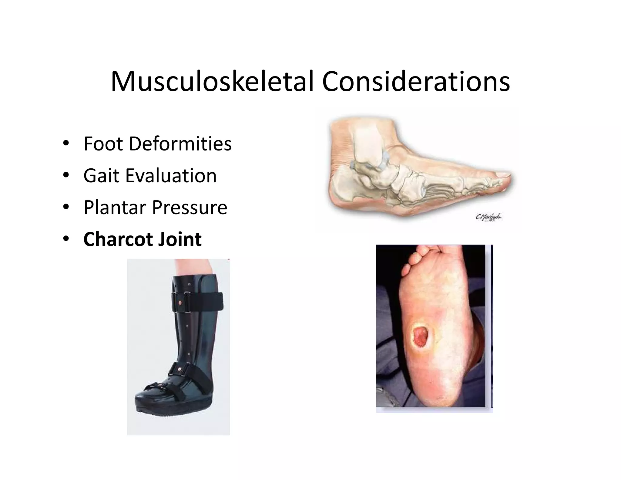 Musculoskeletal Considerations
•   Foot Deformities
•   Gait Evaluation
•   Plantar Pressure
•   Charcot Joint
 