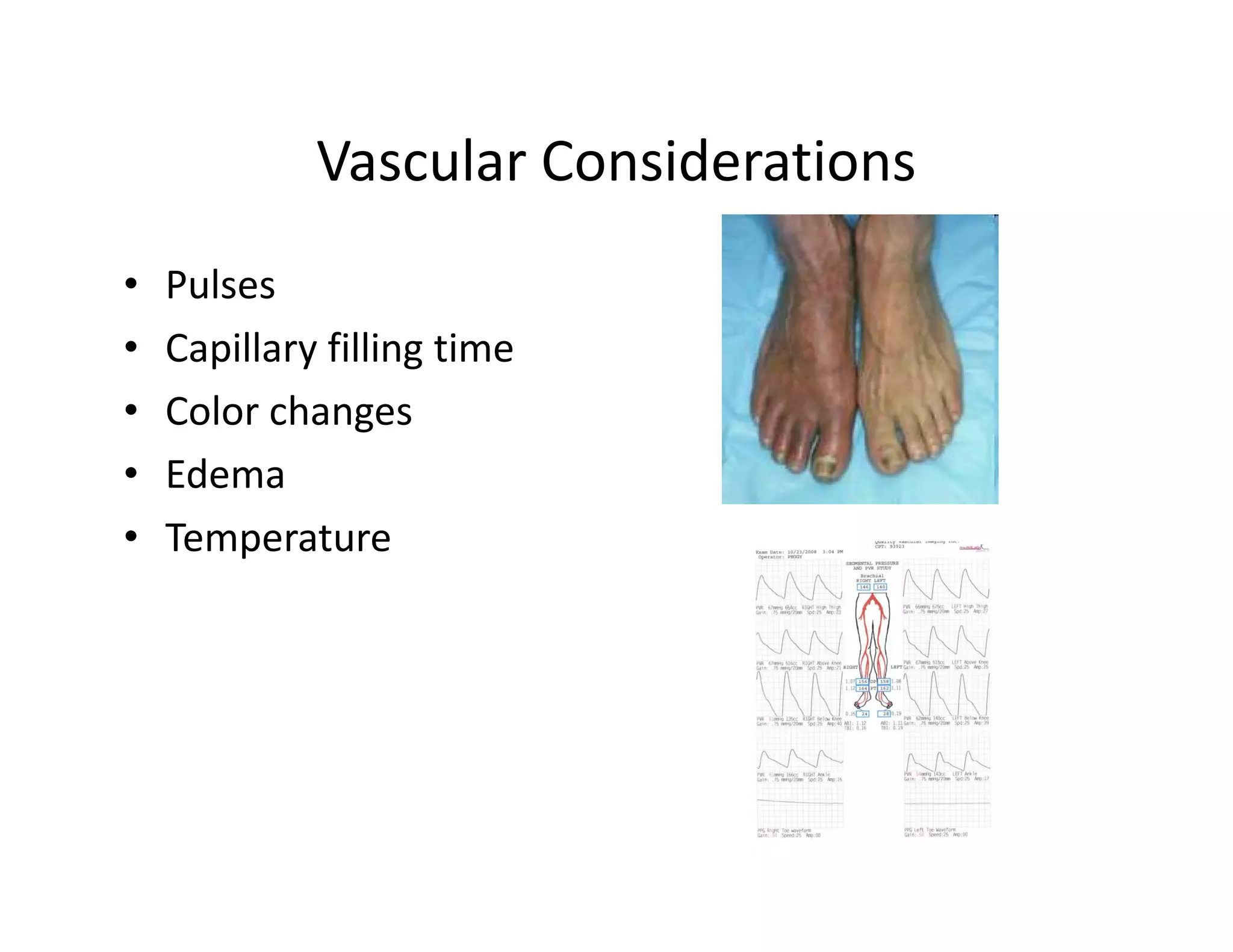 Vascular Considerations
•   Pulses
•   Capillary filling time
•   Color changes
•   Edema
•   Temperature
 