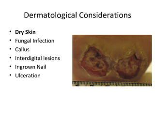 Dermatological Considerations Dry Skin Fungal Infection Callus Interdigital lesions Ingrown Nail Ulceration 