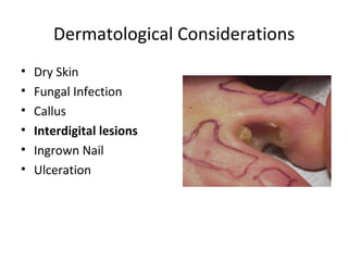 Dermatological Considerations Dry Skin Fungal Infection Callus Interdigital lesions Ingrown Nail Ulceration 
