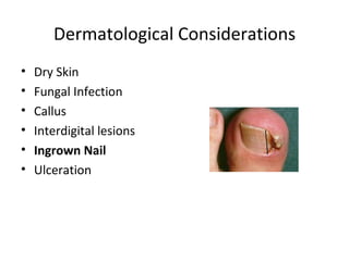 Dermatological Considerations Dry Skin Fungal Infection Callus Interdigital lesions Ingrown Nail Ulceration 
