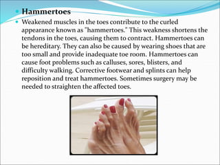  Hammertoes
 Weakened muscles in the toes contribute to the curled
appearance known as "hammertoes." This weakness shortens the
tendons in the toes, causing them to contract. Hammertoes can
be hereditary. They can also be caused by wearing shoes that are
too small and provide inadequate toe room. Hammertoes can
cause foot problems such as calluses, sores, blisters, and
difficulty walking. Corrective footwear and splints can help
reposition and treat hammertoes. Sometimes surgery may be
needed to straighten the affected toes.
 