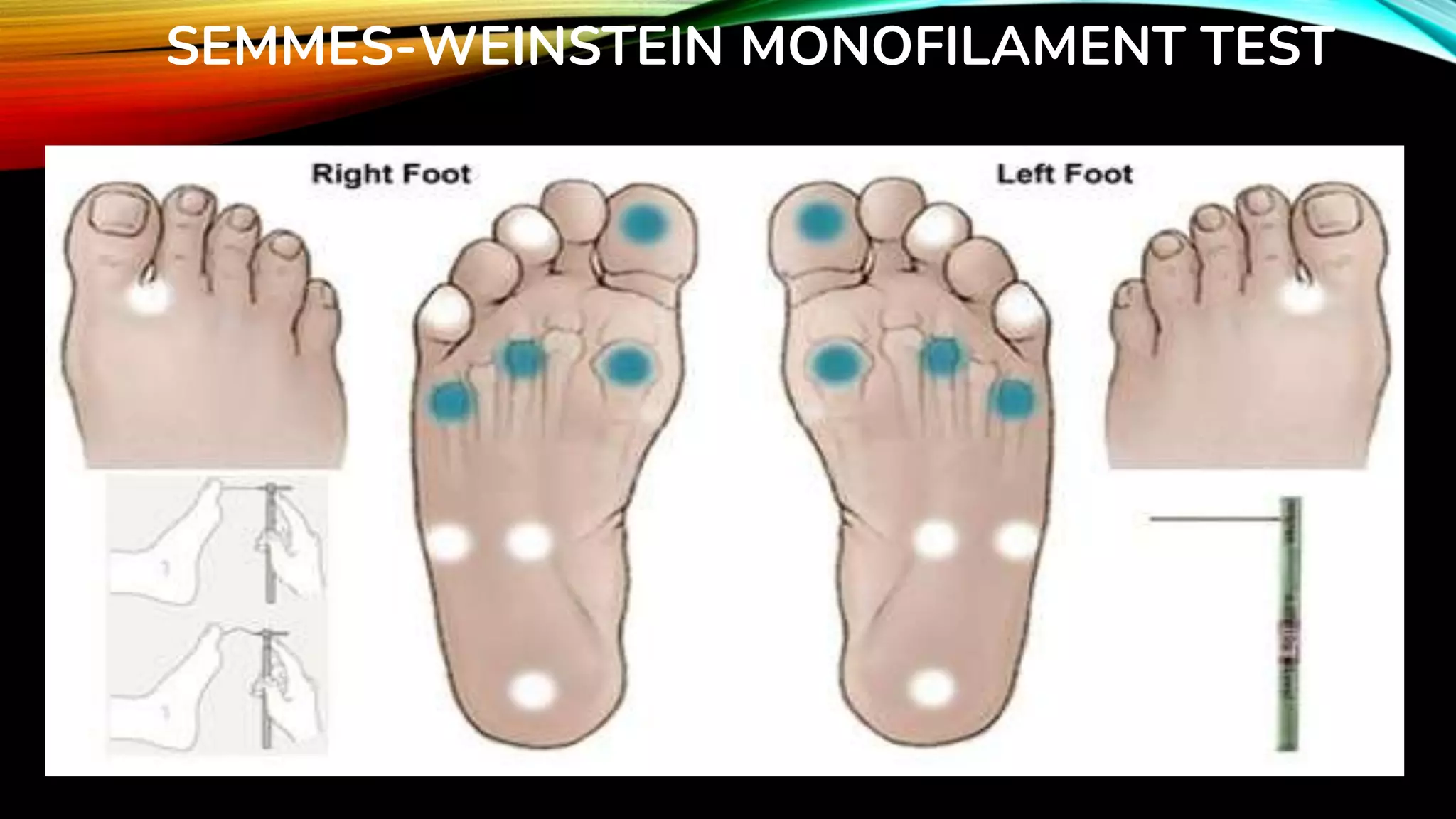 DIABETIC FOOT & STI seminar.pptx