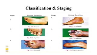 diabetic foot ulcer management in clinics.pptx