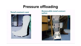 Pressure offloading
 