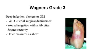 Wagners Grade 3
Deep infection, abscess or OM
- I & D - Serial surgical debridement
- Wound irrigation with antibiotics
- Sequestrectomy
- Other measures as above
 