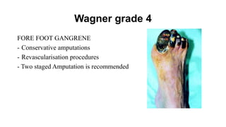 Wagner grade 4
FORE FOOT GANGRENE
- Conservative amputations
- Revascularisation procedures
- Two staged Amputation is recommended
 
