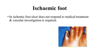Ischaemic foot
• In ischemic foot ulcer does not respond to medical treatment
& vascular investigation is required.
 