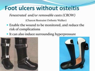 Foot ulcers without osteitis
Fenestrated and/or removable casts (CROW)
(Charcot Restraint Orthotic Walker)
 Enable the wound to be monitored, and reduce the
risk of complications
 It can also induce surrounding hyperpressure
 