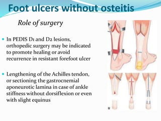 Foot ulcers without osteitis
Role of surgery
 In PEDIS D1 and D2 lesions,
orthopedic surgery may be indicated
to promote healing or avoid
recurrence in resistant forefoot ulcer
 Lengthening of the Achilles tendon,
or sectioning the gastrocnemial
aponeurotic lamina in case of ankle
stiffness without dorsiflexion or even
with slight equinus
 
