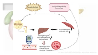 DIABETIC KETOACIDOSIS management in EMERGENCY DEPARTMENT | PPTX