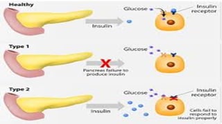 DIABETIC KETOACIDOSIS management in EMERGENCY DEPARTMENT | PPTX