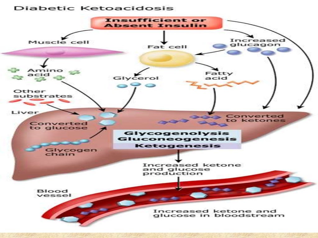 DIABETIC KETOACIDOSIS PRESENTATION BY ROOMA KHALID
