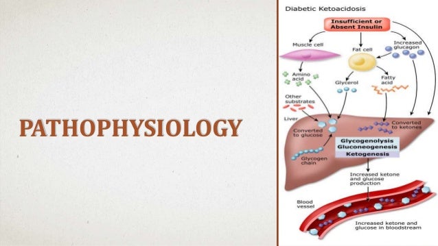 Diabetic ketoacidosis dr jayesh vaghela