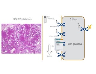 Na+
140 mEq/L Na+
4 mEq/L
Phosphate
amino acids
glucose
H+
3456 mmol/day 50-100 mmol/day
SGLT2 inhibitors
Glucose
less glucose
Phosphorus
Bicarbonate
Amino acids
glucose
 
