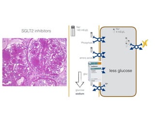 Na+
140 mEq/L Na+
4 mEq/L
Phosphate
amino acids
glucose
H+
3456 mmol/day 50-100 mmol/day
SGLT2 inhibitors
Glucose
less glucose
Phosphorus
Bicarbonate
Amino acids
glucose
sodium
 