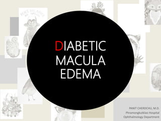 DIABETIC
MACULA
EDEMA
PANIT CHERDCHU, M.D.
Phramongkutklao Hospital
Ophthalmology Department
 