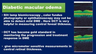 Diabetic macular odema
• Slit lamp biomicroscopy , color fundus
photography or ophthalmoscopy may not be
able to detect mild DME . Here OCT is very
helpful in measuring central foveal thikness.
• OCT has become gold standard in
monitoring the progression and treatment
response in DME
• give micrometer sensitive measurements in
central retinal thickness.
 