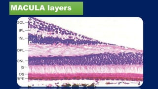 MACULA layers
 