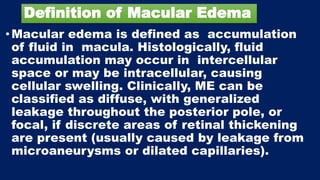 Definition of Macular Edema
• Macular edema is defined as accumulation
of fluid in macula. Histologically, fluid
accumulation may occur in intercellular
space or may be intracellular, causing
cellular swelling. Clinically, ME can be
classified as diffuse, with generalized
leakage throughout the posterior pole, or
focal, if discrete areas of retinal thickening
are present (usually caused by leakage from
microaneurysms or dilated capillaries).
 