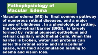 Pathophysiology of
Macular Edema
•Macular edema (ME) is final common pathway
of numerous retinal diseases, and a major
cause of blindness . In a physiological setting,
the blood-retinal barrier (BRB), is largely
formed by retinal pigment epithelium and
retinal capillary endothelial cells. When this
barrier is broken, water and proteins can
enter the retinal extra- and intracellular
space, with fluid accumulation leading to
edema and vision loss.
 