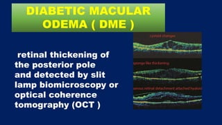 retinal thickening of
the posterior pole
and detected by slit
lamp biomicroscopy or
optical coherence
tomography (OCT )
DIABETIC MACULAR
ODEMA ( DME )
 