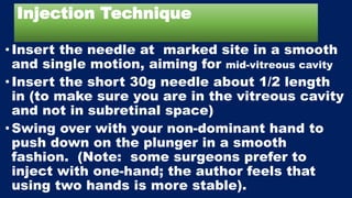 Injection Technique
•Insert the needle at marked site in a smooth
and single motion, aiming for mid-vitreous cavity
•Insert the short 30g needle about 1/2 length
in (to make sure you are in the vitreous cavity
and not in subretinal space)
•Swing over with your non-dominant hand to
push down on the plunger in a smooth
fashion. (Note: some surgeons prefer to
inject with one-hand; the author feels that
using two hands is more stable).
 