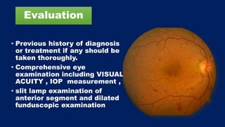 Evaluation
• Previous history of diagnosis
or treatment if any should be
taken thoroughly.
• Comprehensive eye
examination including VISUAL
ACUITY , IOP measurement ,
• slit lamp examination of
anterior segment and dilated
funduscopic examination
 