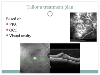 Tailor a treatment plan
Based on
FFA
OCT
Visual acuity
 