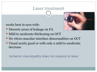 Laser treatment
works best in eyes with-
Discrete areas of leakage on FA
Mild to moderate thickening on OCT
No vitreo-macular interface abnormalities on OCT
Visual acuity good or with only a mild to moderate
decrease
Ischemic maculopathy does not respond to laser
 