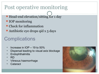 Post operative monitoring
Head-end elevation/sitting for 1 day
IOP monitoring
Check for inflammation
Antibiotic eye drops qid x 5 days
• Increase in IOP – 19 to 50%
• Dispersal leading to visual axis blockage
• Endophthalmitis
• RD
• Vitreous haemorrhage
• Cataract
Complications
 