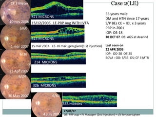 55 years male
DM and HTN since 17 years
S/P BEs CE + IOL x 3 years
PRP in 2001
IOP: OS-18
20 OCT 07 OS: AGS at Aravind
Last seen on
22 APR 2008
IOP: OD-20 OS-25
BCVA : OD: 6/36 OS: CF 3 MTR
Case 2(LE)
10 nov 2006
1 mar 2007
23 Apr 2007
30 May 2007
333 microns
326 MICRONS
871 MICRONS
525 MICRONS
CF 3 Meter
6/60
6/24
6/60
6/36
214 MICRONS
4 July 2007
15/12/2006 LE-PRP Aug WITH IVTA
15 mar 2007 LE- IV macugen given(1 st injection)
27/08/07
OS: PRP aug + IV Macugen (2nd injection) + s/t Kenacort given
 