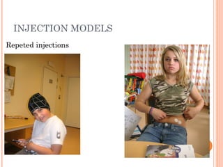 INJECTION MODELS
Repeted injections
Future
intelligent
pumps
with reliable
sensors for
glucose levels
= mechanical
pancreas
 